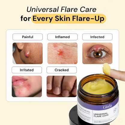 Universal Flare Cream