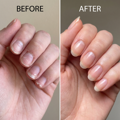 Hair, Skin and Nails Strips